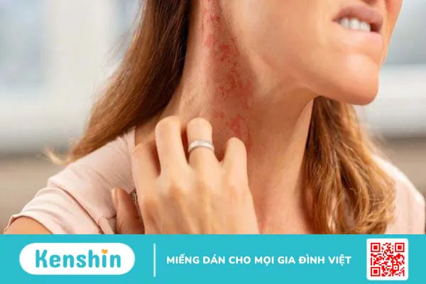 1 ly trà sữa bao nhiêu calo? Uống trà sữa có mập không?