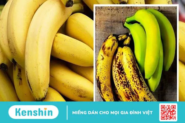 1 quả chuối bao nhiêu calo? Ăn chuối có béo không và lưu ý khi ăn