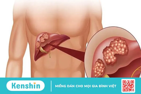 1 quả trứng gà bao nhiêu calo? Ăn nhiều trứng gà có tốt không?