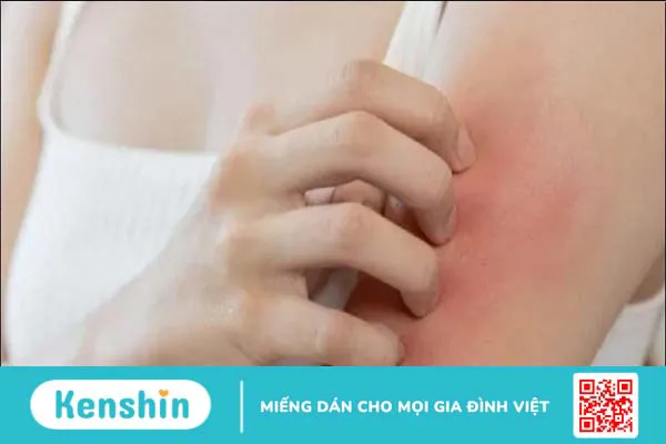 1 trái vú sữa bao nhiêu calo? Ăn vú sữa có mập không? Cách ăn giảm cân