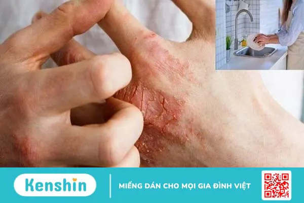 10 bệnh da liễu thường gặp và các biện pháp phòng ngừa hiệu quả