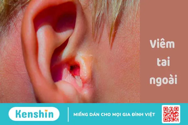 10 bệnh tai mũi họng thường gặp ở người lớn và trẻ em