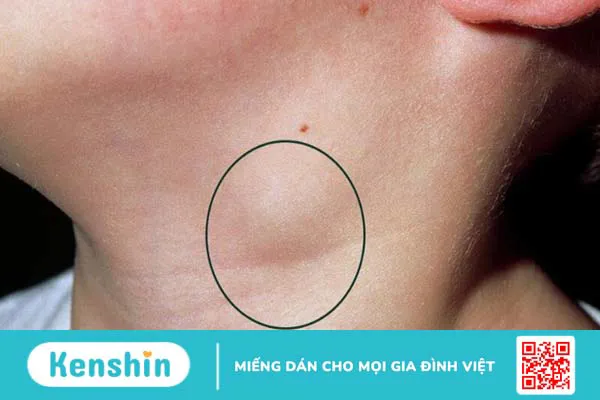 10 bệnh tai mũi họng thường gặp ở người lớn và trẻ em