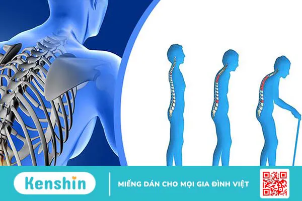 10 biến chứng viêm khớp dạng thấp bạn nên chú ý