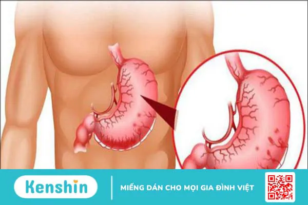 10 biến chứng xơ gan bạn không nên xem thường