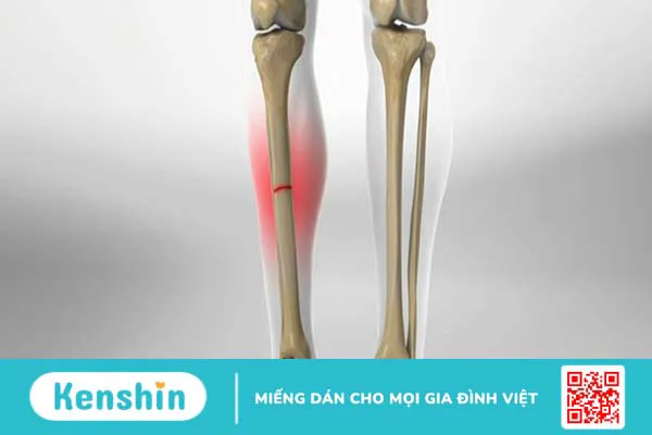 10 biến chứng xơ gan bạn không nên xem thường