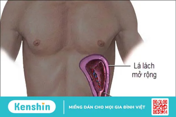 10 biến chứng xơ gan bạn không nên xem thường