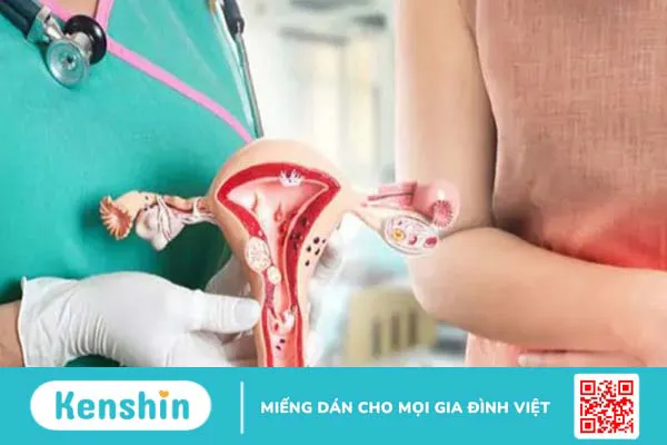 10 cách chữa viêm âm đạo tại nhà an toàn, hiệu quả và cách phòng ngừa