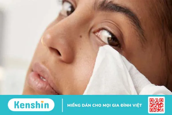 10 cách trị lẹo mắt NHANH NHẤT trong 1 đêm đơn giản hiệu quả