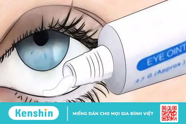 10 cách trị lẹo mắt NHANH NHẤT trong 1 đêm đơn giản hiệu quả