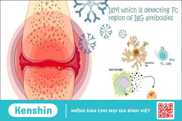 10 dấu hiệu giảm cân thành công bạn không nên bỏ qua