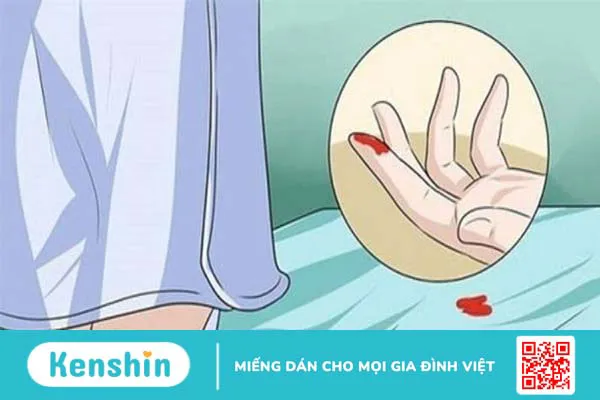 10 dấu hiệu ung thư cổ tử cung chị em không nên bỏ qua