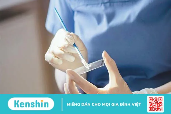 10 dấu hiệu ung thư cổ tử cung chị em không nên bỏ qua