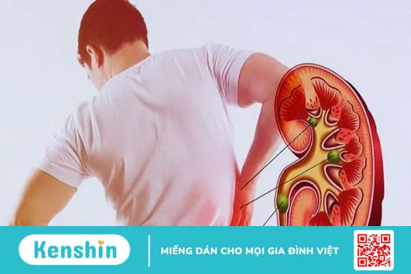 10 lợi ích của lá ổi trị bệnh tiểu đường và một số bài thuốc từ lá ổi