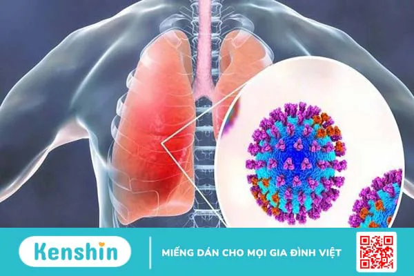 10 nguyên nhân dẫn đến bệnh amidan có thể bạn chưa biết