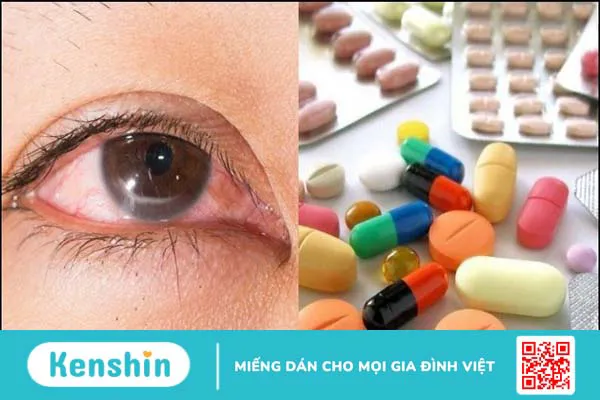 10 nguyên nhân gây ngứa mắt và cách làm dịu cơn ngứa nhanh chóng