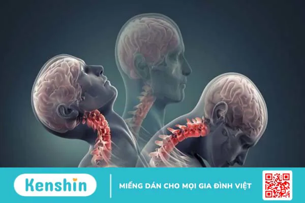 10 nguyên nhân rối loạn tiền đình phổ biến bạn nên lưu ý