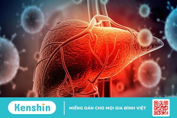 10 phương pháp tầm soát ung thư gan? Ai nên tầm soát sớm?