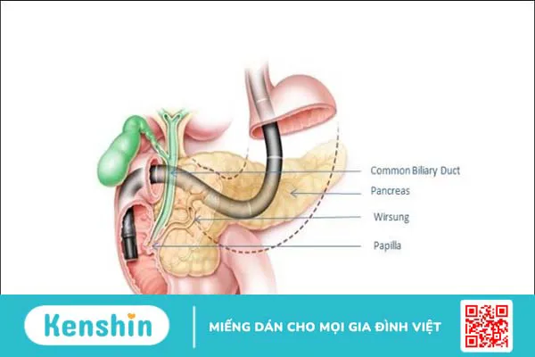 10 phương pháp tầm soát ung thư gan? Ai nên tầm soát sớm?