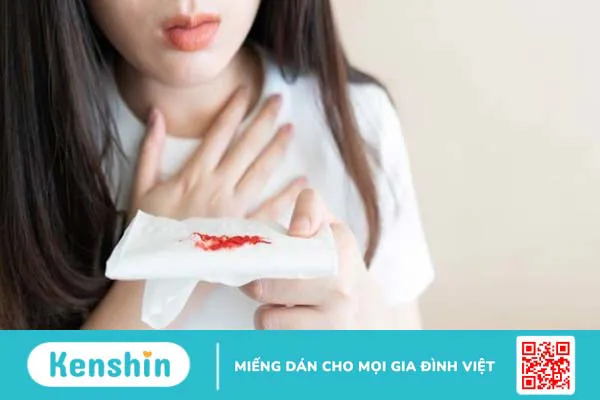 10 tác dụng của rau kinh giới đối với sức khoẻ có thể bạn chưa biết