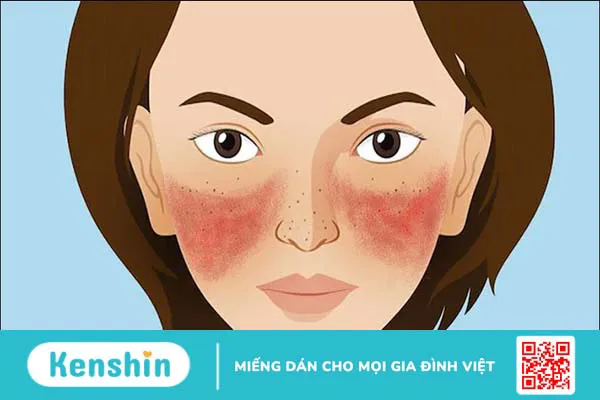 10 tác dụng phụ của tảo xoắn Nhật Bản và lưu ý khi sử dụng