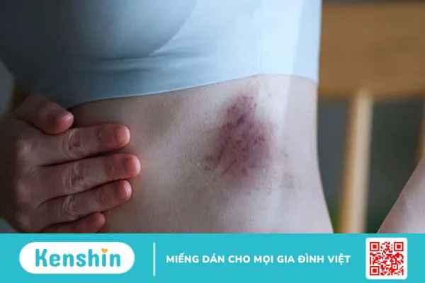 10 tác dụng phụ của tảo xoắn Nhật Bản và lưu ý khi sử dụng