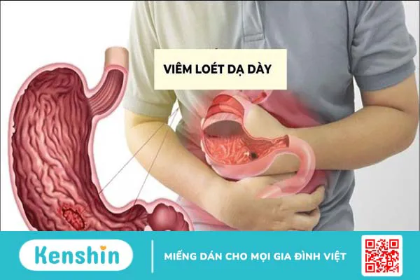 10 tác hại của ớt đối với sức khỏe – Ai không nên ăn ớt cần lưu ý ngay!