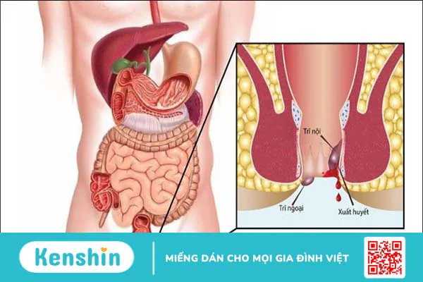 10 tác hại của ớt đối với sức khỏe – Ai không nên ăn ớt cần lưu ý ngay!