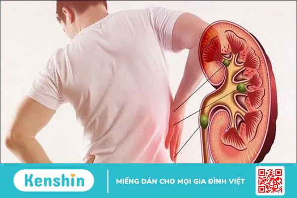 10 tác hại của ớt đối với sức khỏe – Ai không nên ăn ớt cần lưu ý ngay!