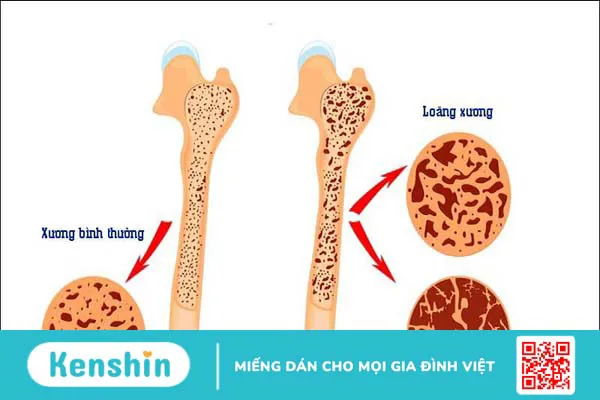 10 triệu chứng tiền mãn kinh phổ biến ở phụ nữ bạn nên biết