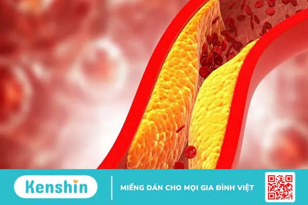 10 triệu chứng tiền mãn kinh phổ biến ở phụ nữ bạn nên biết