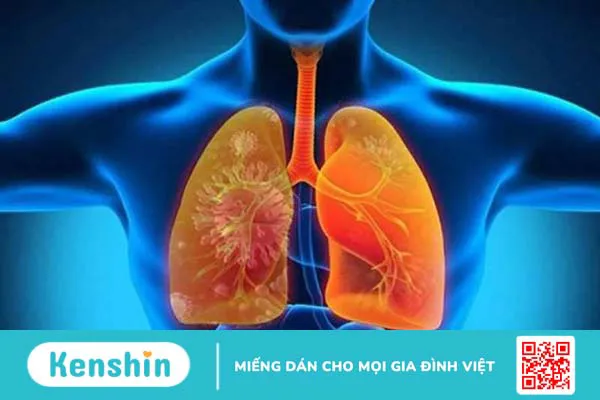 100g cá lóc bao nhiêu calo? Ăn cá lóc có mập không? Cách ăn giảm cân