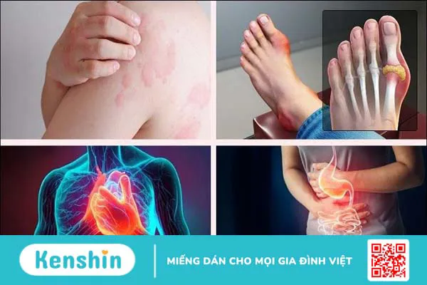 100g chân gà bao nhiêu calo? Ăn chân gà có mập không? Lưu ý khi ăn