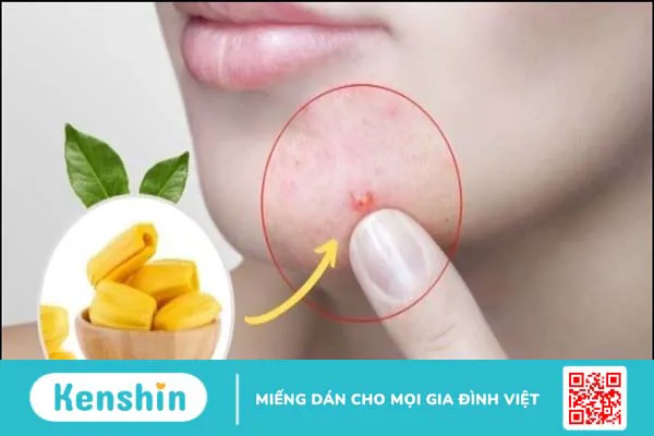 100g mít bao nhiêu calo? Ăn mít có béo không và ai không nên ăn?