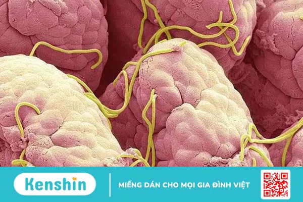 100g thịt heo bao nhiêu calo? Ăn thịt heo có gây béo không?