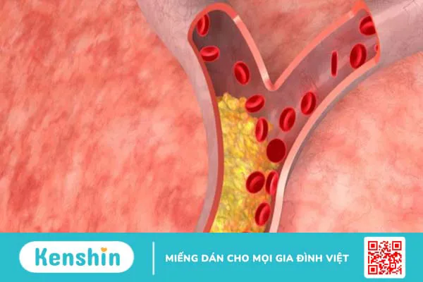 100g yến mạch bao nhiêu calo? Cách ăn yến mạch giảm cân tại nhà