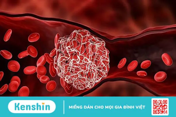 11 bệnh về máu thường gặp, nguyên nhân và cách phòng ngừa