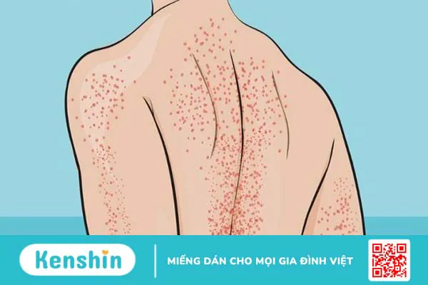 11 bệnh về máu thường gặp, nguyên nhân và cách phòng ngừa