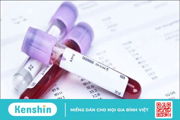 11 bệnh về máu thường gặp, nguyên nhân và cách phòng ngừa