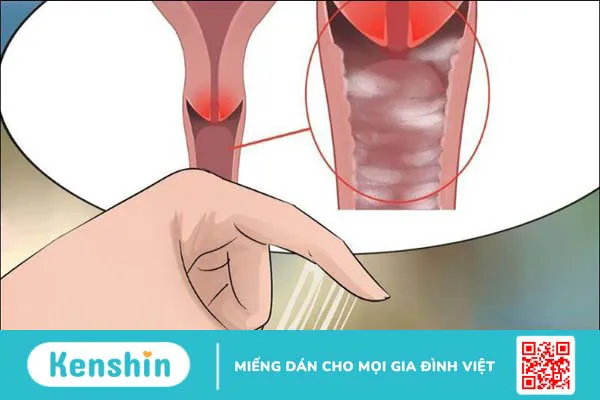 11 cách chăm sóc vùng kín – Các nguyên tắc nhất định nàng phải lưu ý