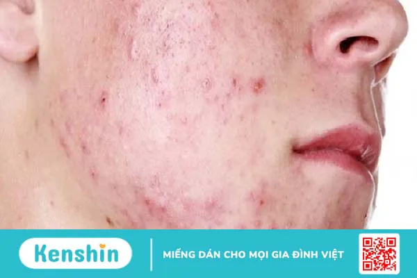 11 cách làm đẹp bằng sữa chua không đường đơn giản, hiệu quả