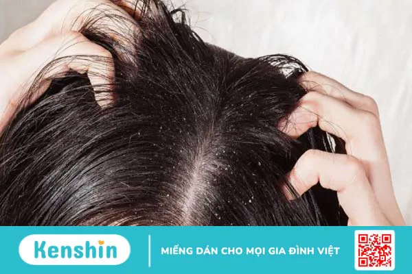 11 cách làm đẹp bằng sữa chua không đường đơn giản, hiệu quả