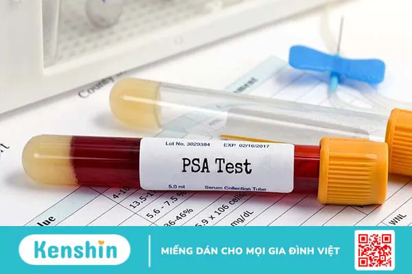 11 cách làm giảm phì đại tuyến tiền liệt tại nhà đơn giản, hiệu quả