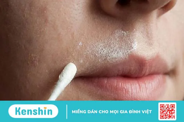 11 dấu hiệu vô sinh ở phụ nữ không nên bỏ qua