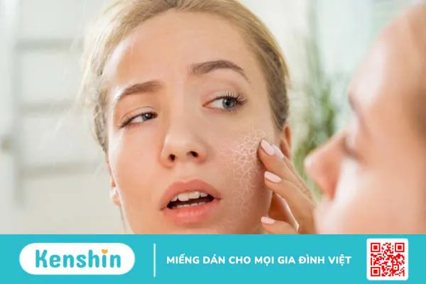 11 mẹo chữa da khô mùa đông bạn không nên bỏ qua