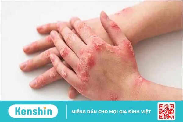 11 nguyên nhân gây ung thư da bạn không nên xem thường