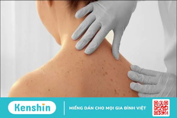 11 nguyên nhân gây ung thư da bạn không nên xem thường