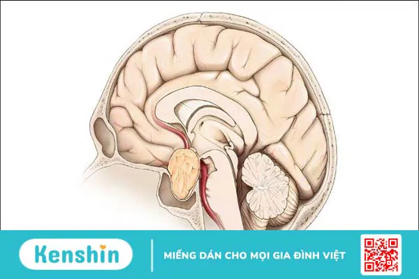 11 nguyên nhân rụng tóc ở nữ nên lưu ý ngay để phòng tránh