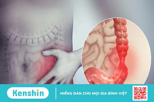 11 nguyên nhân táo bón và cách phòng ngừa bạn cần biết