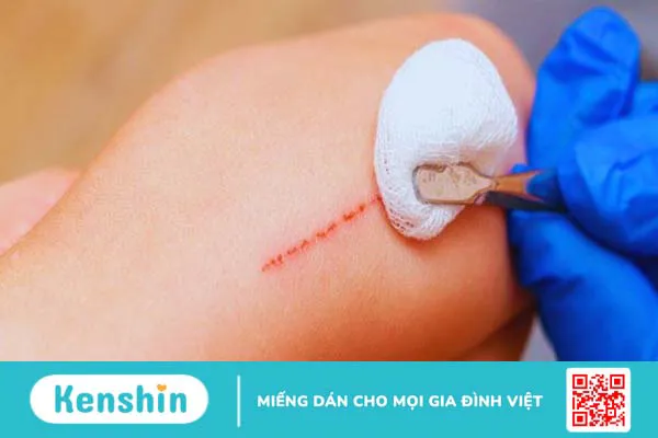 11 tác dụng của nấm lim xanh tốt cho sức khỏe và cách dùng an toàn